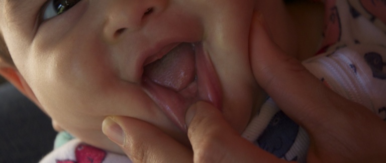 Ava Has a Tooth
